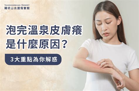 臉癢|常常皮膚癢怎麼辦：原因、處理重點指南大全